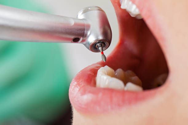 Best Walk-In Emergency Dentist in Richfield, MN